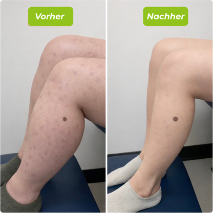 VitaKnie™ - Frei bewegen – jeden Tag
